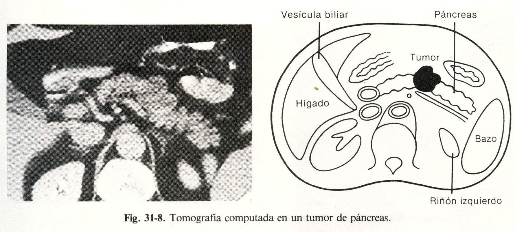 abdomen05