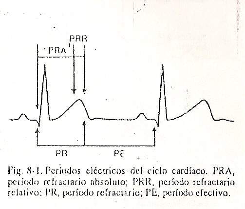 arrhythmia02