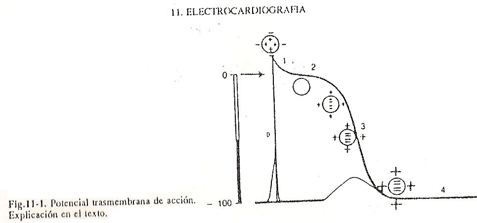 ecg01