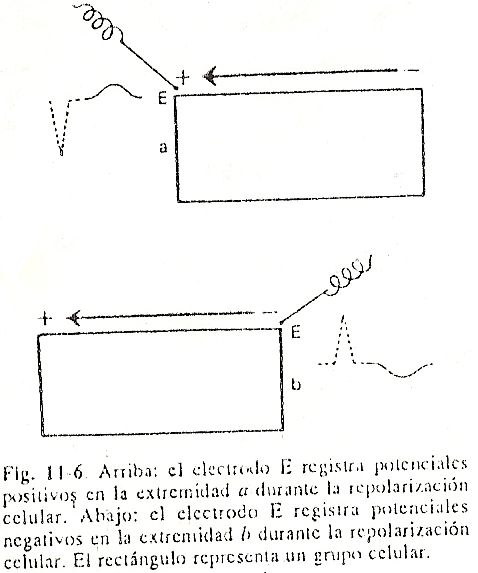 ecg06