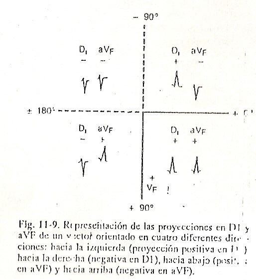 ecg09