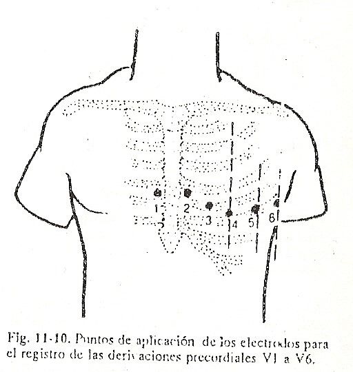 ecg10