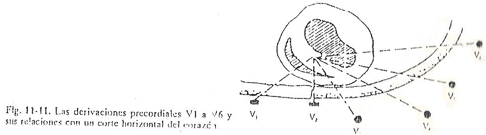 ecg11