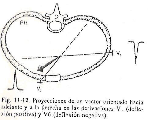 ecg12