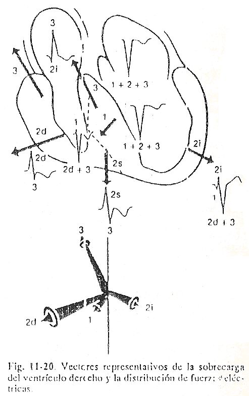 ecg18