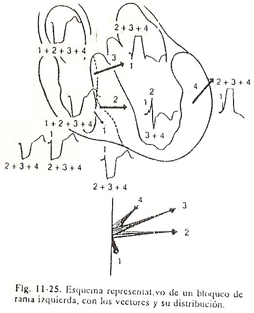 ecg24