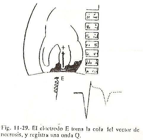 ecg28