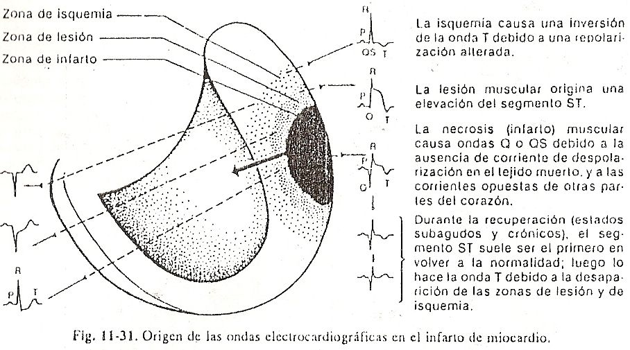 ecg30