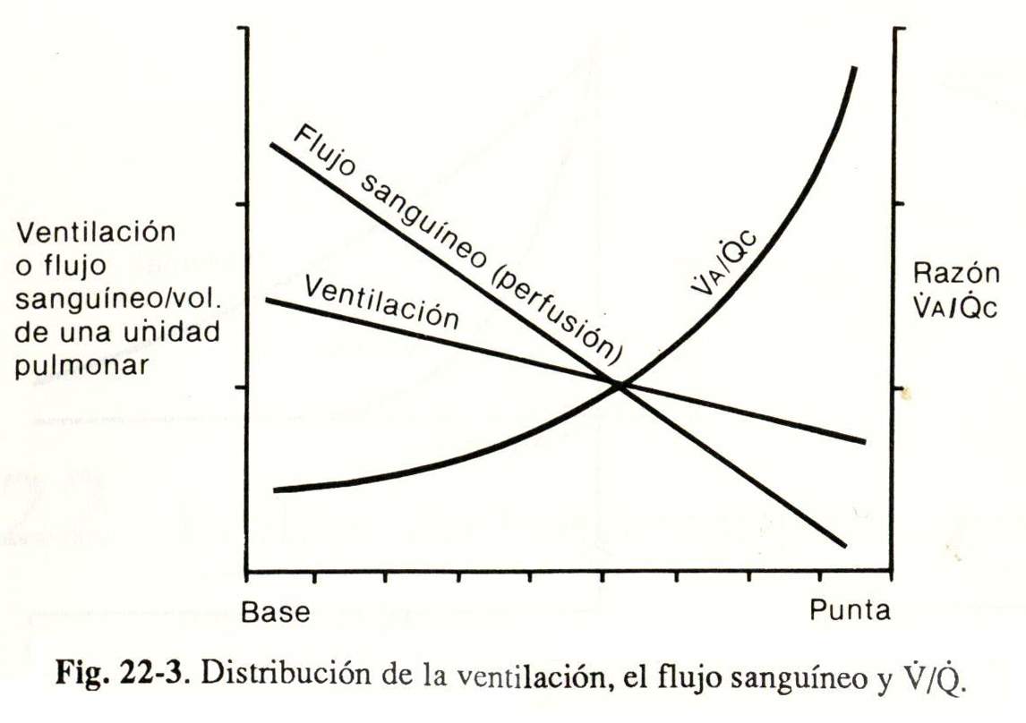 spiro03