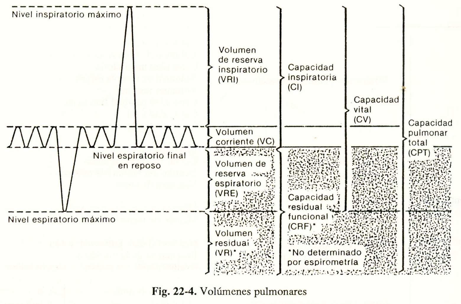 spiro05