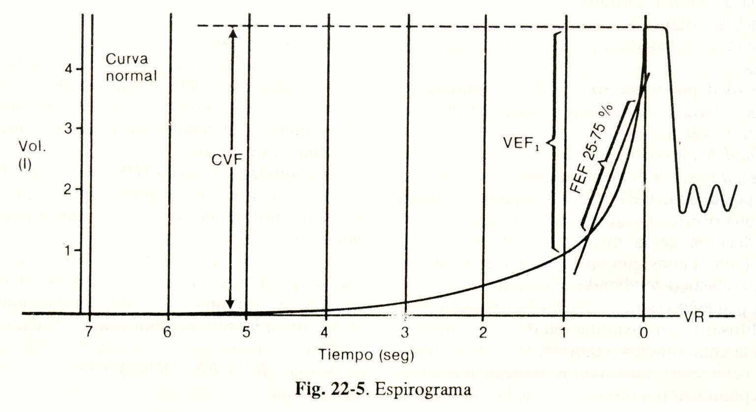 spiro06