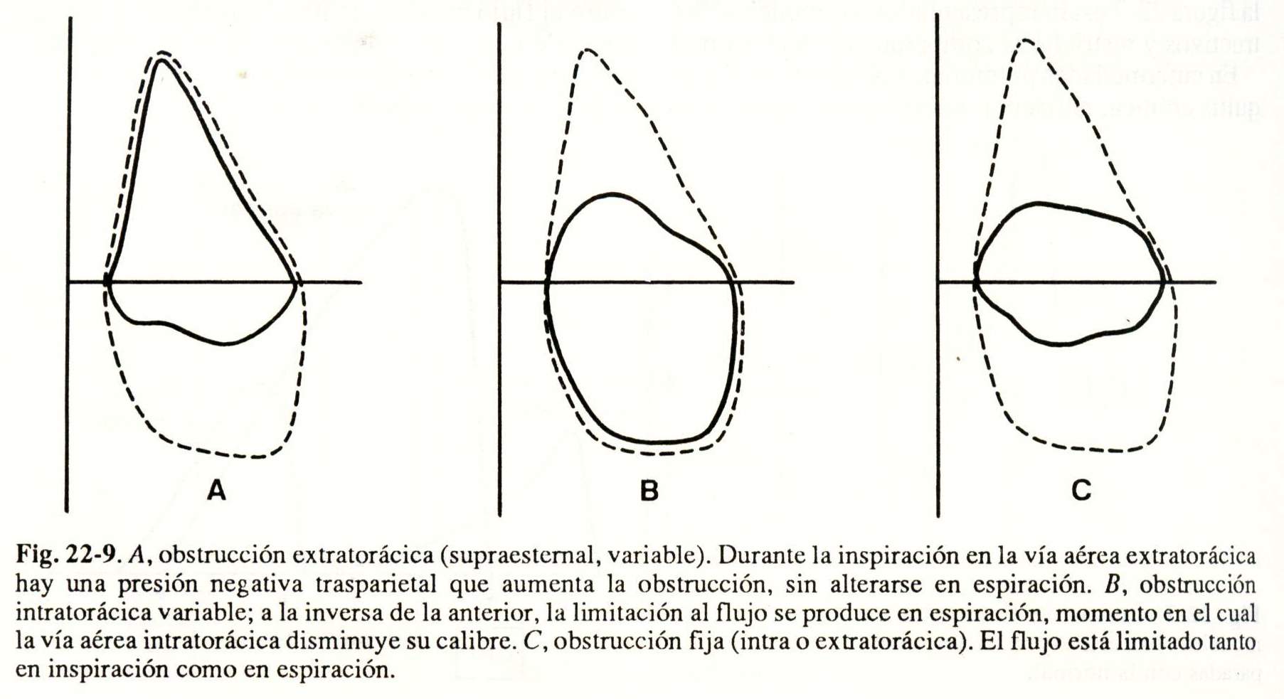 spiro10