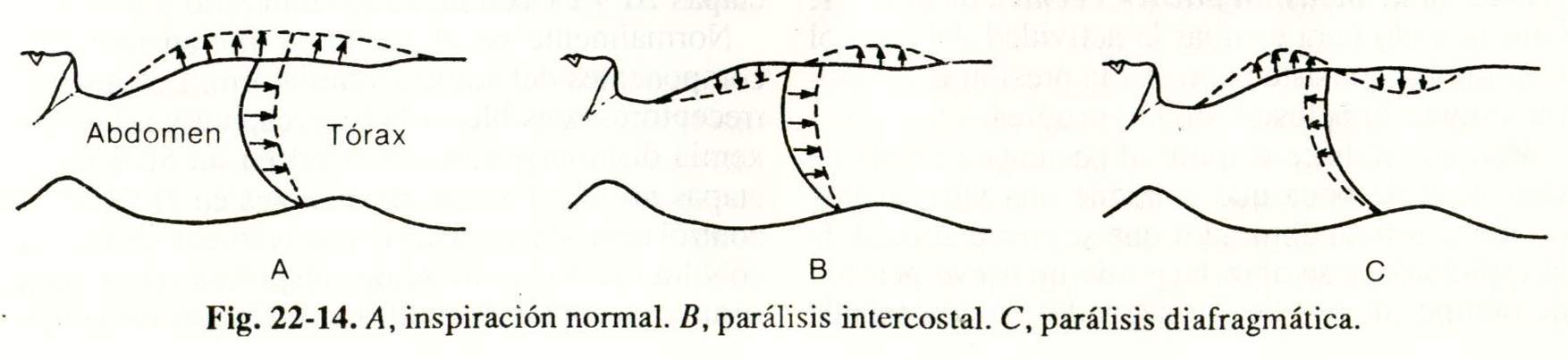 espiro14