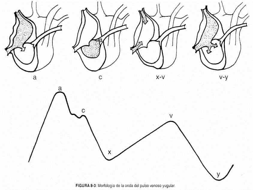 excardio03