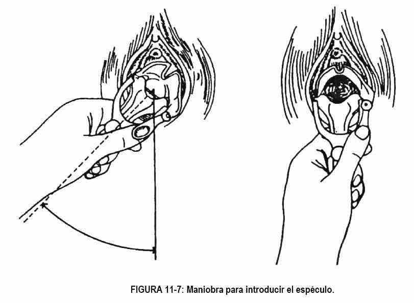 exgenitales07