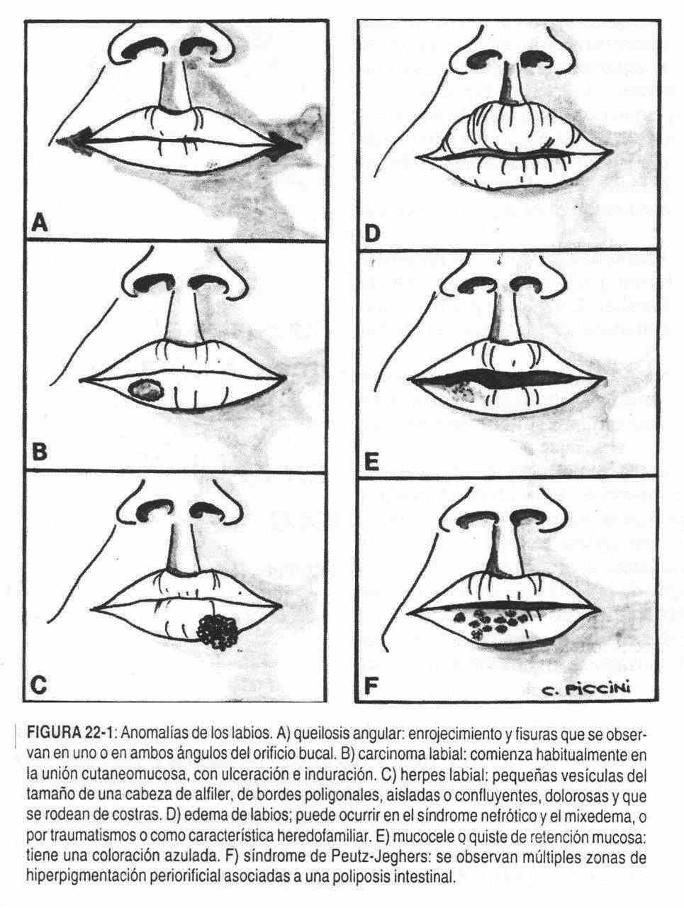 haboca01