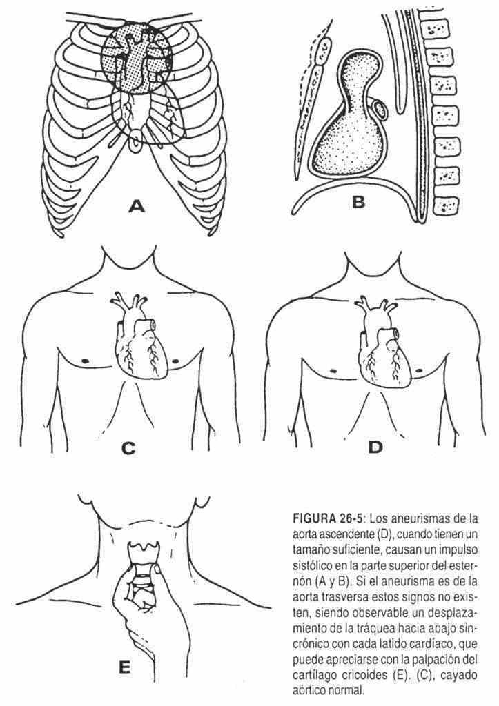 hacardio05