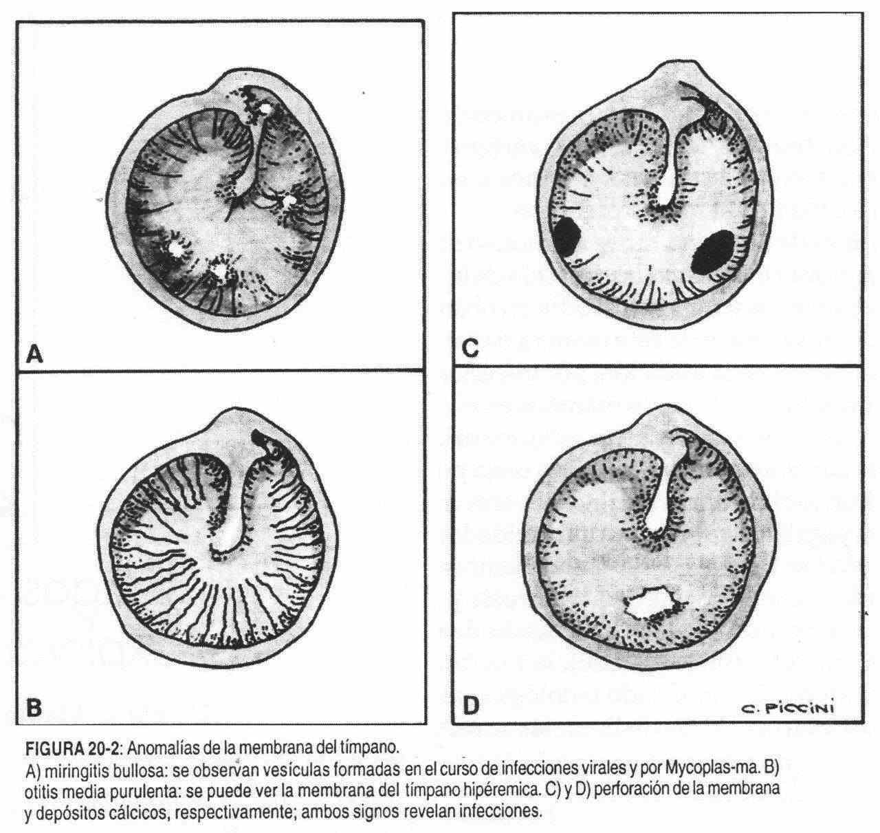 Abnormal findings on ear examination