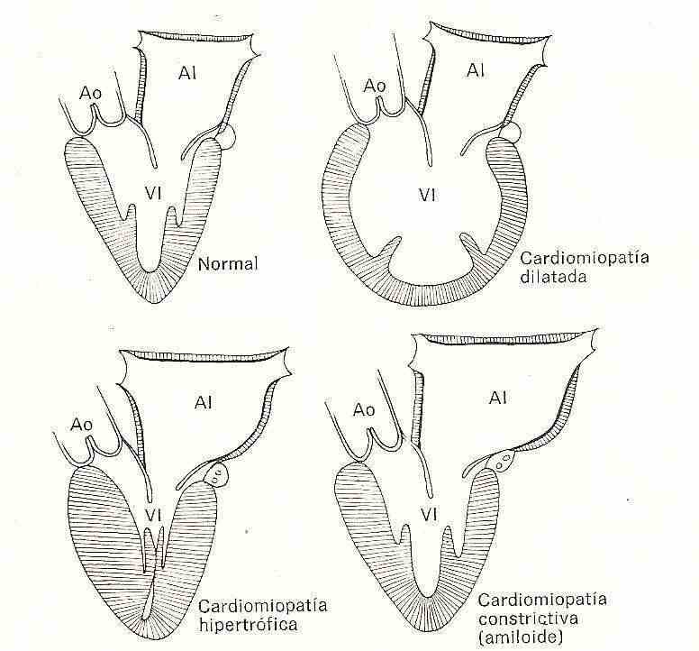 myocardium1