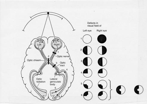 ophthalmus