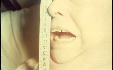 46