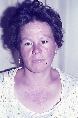 49
