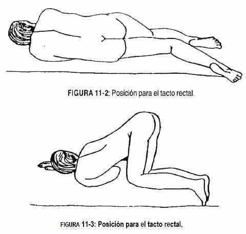 exgenitales02